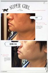 光SPA小V脸-光SPA科技美肤