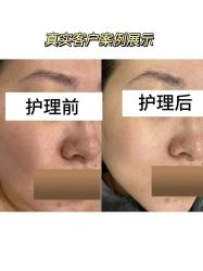 -星港国际·Skin皮肤专研·皮肤管理
