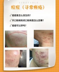 -苗方清颜痘肌研究所