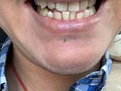 -佛山中大口腔医院·市二级口腔专科医院