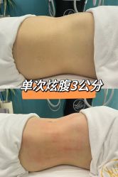 点击看大图 -Lily纤美·科技减脂中心