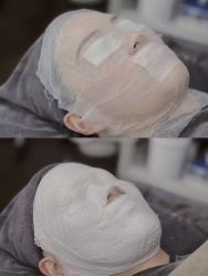 -木棉问题肌·肩颈·纹绣