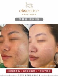 -VE专注问题肌·赛诺龙&科学美肤中心