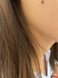 -美瑞莎创美医疗美容