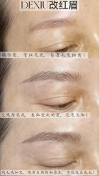 -德绣·机器野生眉发际线·美瞳线半永久
