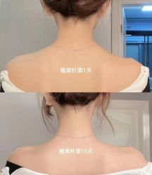 -上海漾颜医疗美容