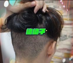 -大麦微针植发全国连锁