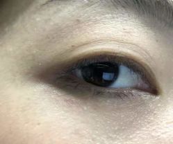 -美人痣全国连锁