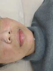 -长沙雅美医疗美容医院