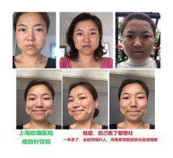 -上海玫瑰医疗美容医院