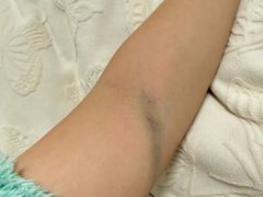 -四川省人民医院(本部)