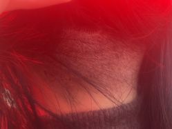 -碧莲盛·不剃发植发