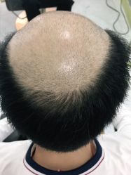 -发饰美男士增发补发假发定制店