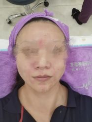 -新美荟医美·专注面部美学抗衰