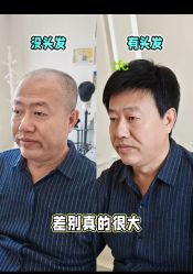-唐风采假发补发定制