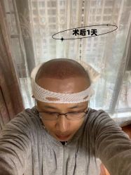 -雍禾植发全国连锁