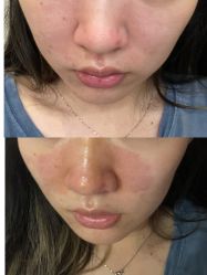 体验前-上海首尔丽格医疗美容医院