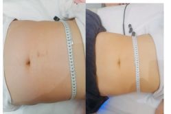 -Lily纤美·科技减脂中心