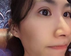 -广州美莱医疗美容医院