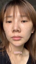 -空军总医院激光整形美容中心