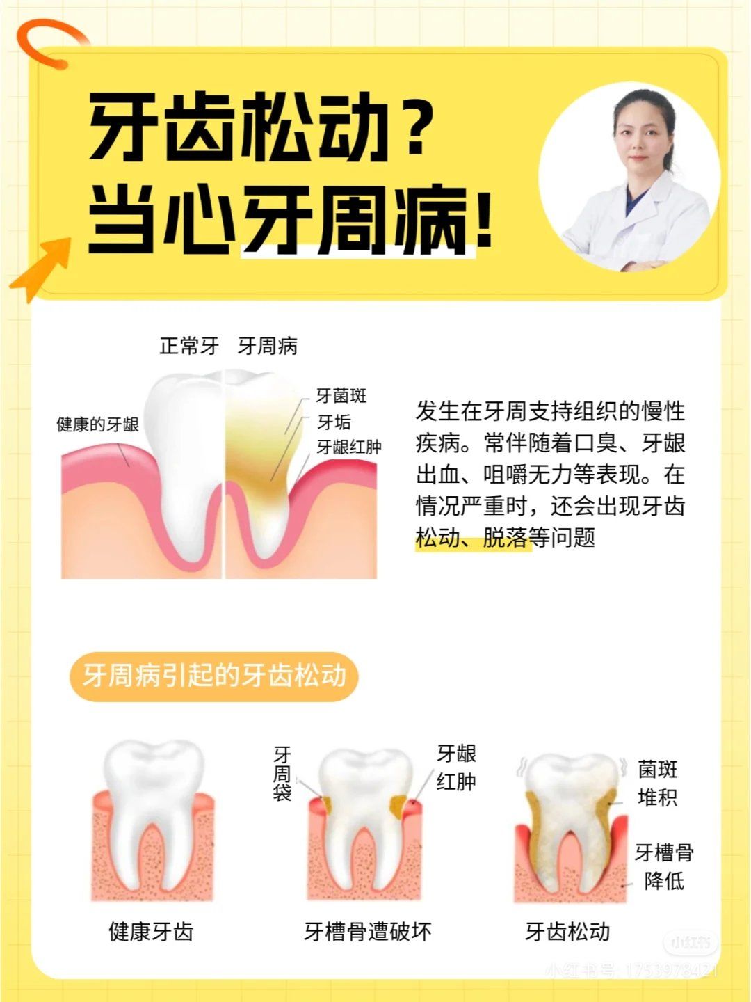 什么人容易得牙周炎百科在线