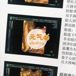-艾博尔医院