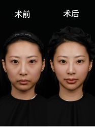 -北京叶子整形美容医院