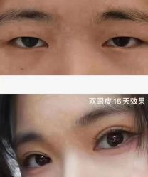-资医堂·除疤祛痘祛斑