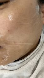 体验后-联合丽格·张菡丽格医疗美容