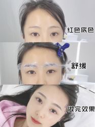 -久匠·纹眉纹绣半永久