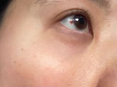 -上海大学附属上海和平眼科医院