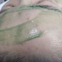 -JM皮肤管理中心