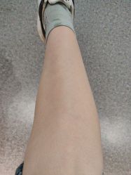 体验后-西安伊美尔医疗美容医院