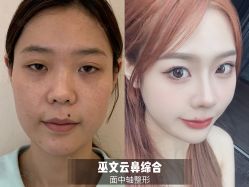 -北京米扬丽格医疗美容·联合丽格鼻整形中心