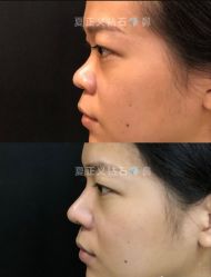 -北京米扬丽格医疗美容·联合丽格鼻整形中心