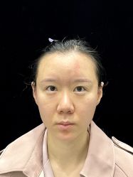 体验前-上海漾颜医疗美容