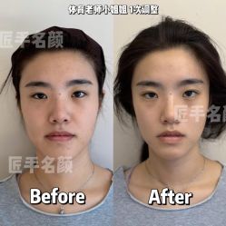 -颜和骨正·明哲式骨相美学整骨