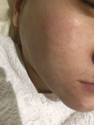 -MedSkinCare科技祛痘肌肤修护中心