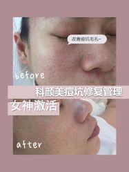 -美肤盾祛痘·问题肌头疗管理中心