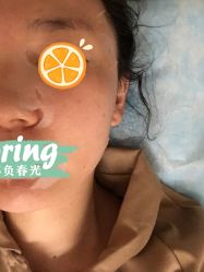 体验后-纯粹医美