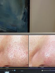 -苑苑vbeauty科技美容SPA