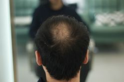 -发饰美男士增发补发假发定制店