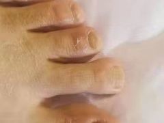 -世龙世家灰指甲·甲沟炎·跖疣护理·修脚(东江湾路店)