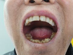 -极光口腔·矫正种植修复(锦江院区)