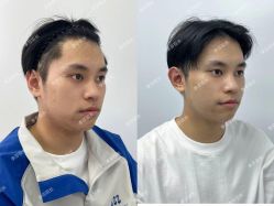 -杭州米兰柏羽医疗美容医院