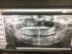 -深圳佑诺口腔门诊部