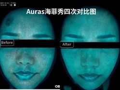 -AURAS璈然科技护肤中心