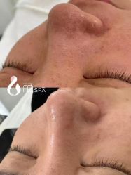 点击看大图 -栖SPA·ONDA ·海菲秀·皑皑科技美肤中心