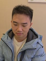 -大麦微针植发全国连锁