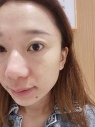 体验后-康美贞·痘肌养护管理中心